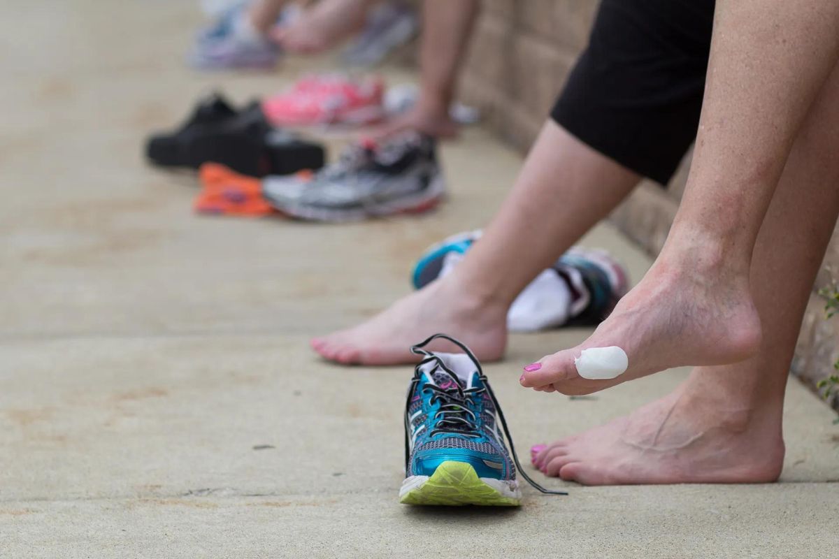 Runner's feet with blisters caused by running gfgf